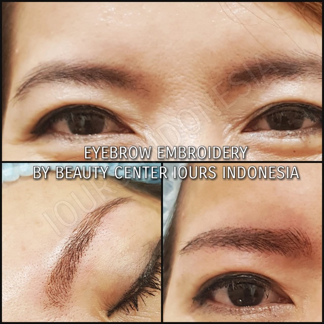 Beauty Treatment